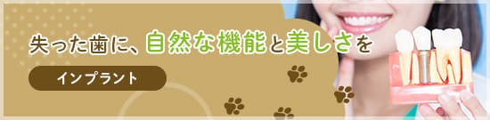 インプラント